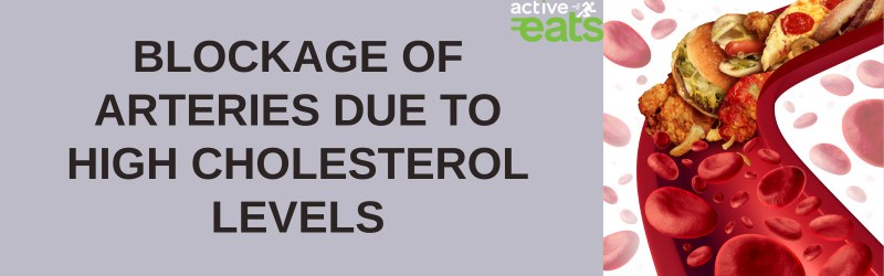 High cholesterol levels can lead to the buildup of plaque in arteries, causing a condition called atherosclerosis. This plaque narrows and stiffens the arteries, reducing blood flow to vital organs, including the heart. Severe blockage can result in angina, heart attacks, or strokes, posing significant health risks.
