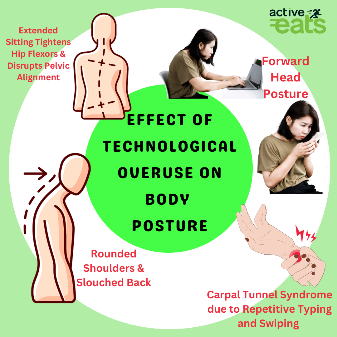 Image: A series of posture illustrations showing the impact of technological overuse on the human body. These illustrations depict changes in posture, including forward head tilt, rounded shoulders, hunched back, and slouched posture. The image illustrates how excessive technology use can negatively affect body posture.