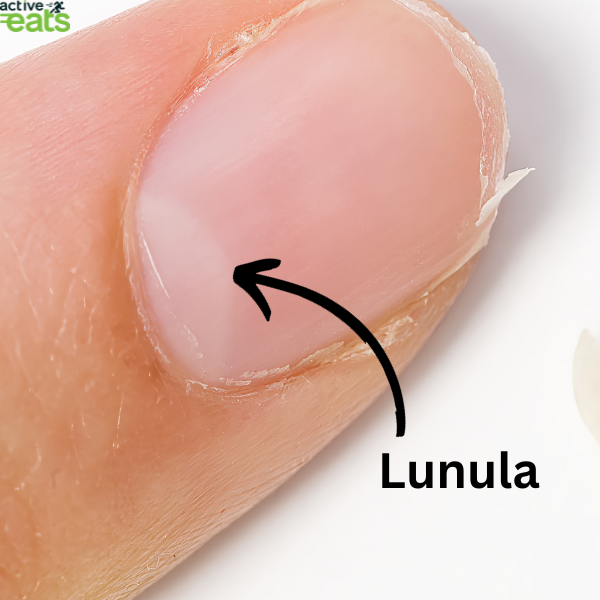  image shows a clear image of finger nail showing half moon lunula. This pattern in body nails indicate various underlying health issues. 