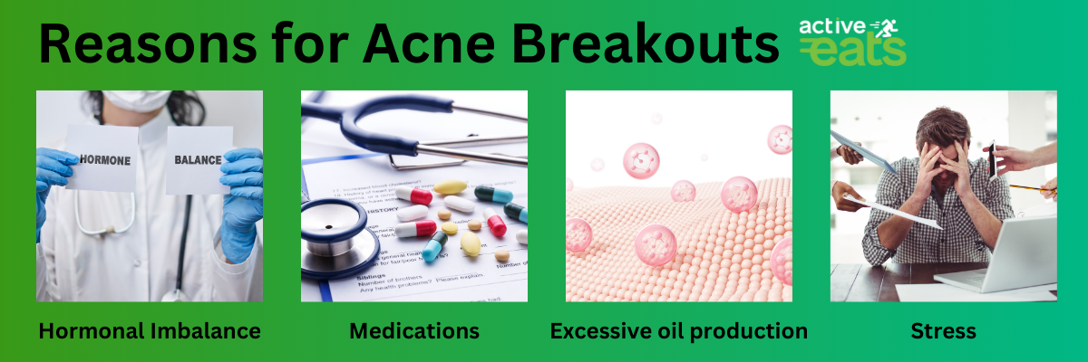 Image shows the reasons for acne breakouts like excellsive skin oil production, hormonal imbalance, high stress levels and certain medications