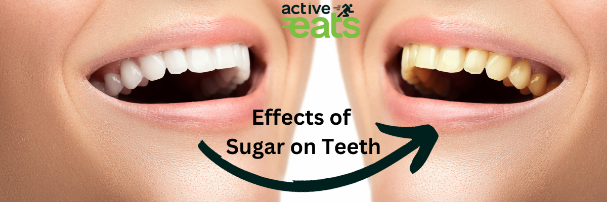 Picture shows white clear teeth on one side and yellowish teeth on other side which indicates the harmful effects of sugar consumption on teeth