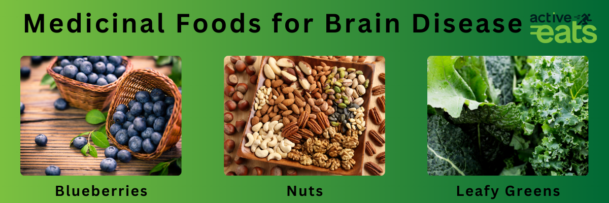 picture showing various medicinal foods for brain like Blueberries, nuts and leafy greens. 