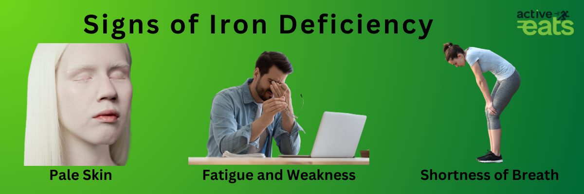 Picture shows common signs of iron deficiency which are fatigue and tiredness along with pale skin and shortness or breath
